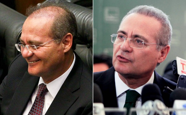 Renan Calheilhos, presidente do Senado: implante de cabelo