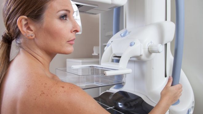 Mamografia, capaz de detectar nódulos na mama que ainda não são palpáveis, é recomendada para mulheres a partir dos 40 anos